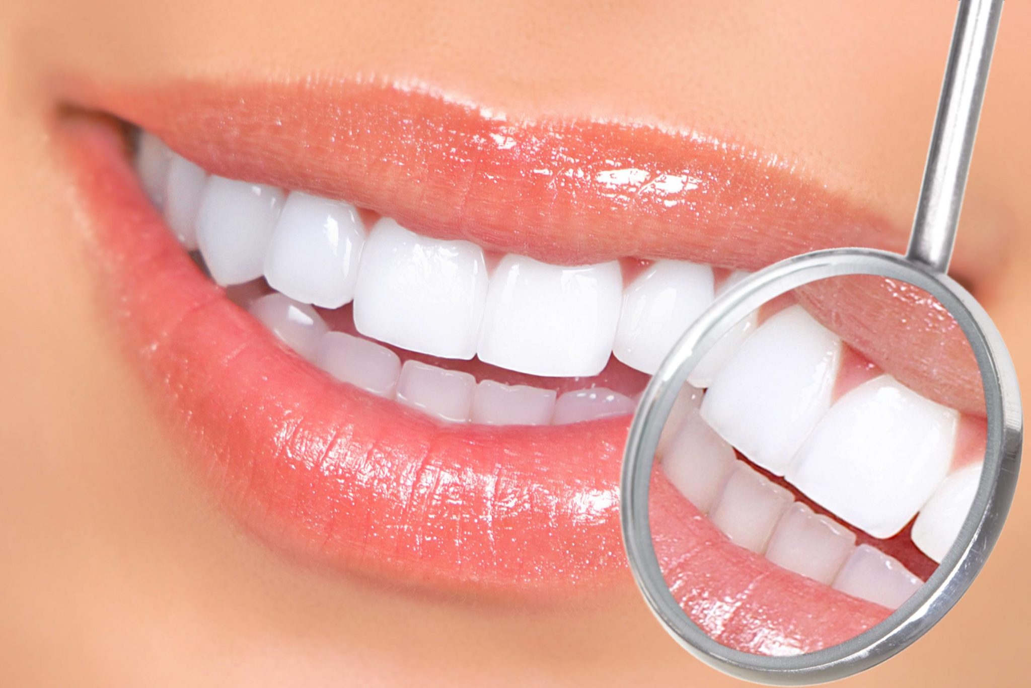 Non peroxide teeth whitening